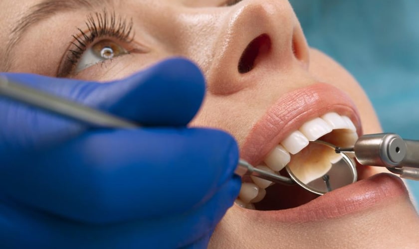 Terapie stomatologică